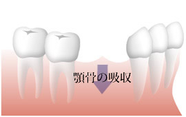 欠損