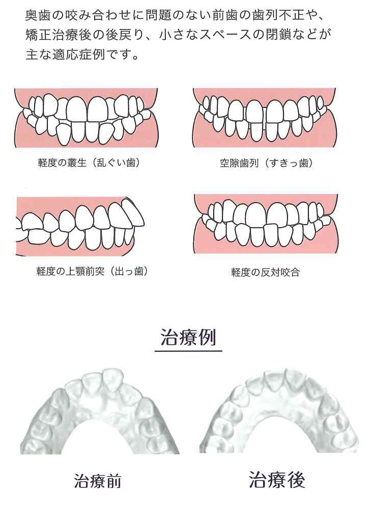 適応症例