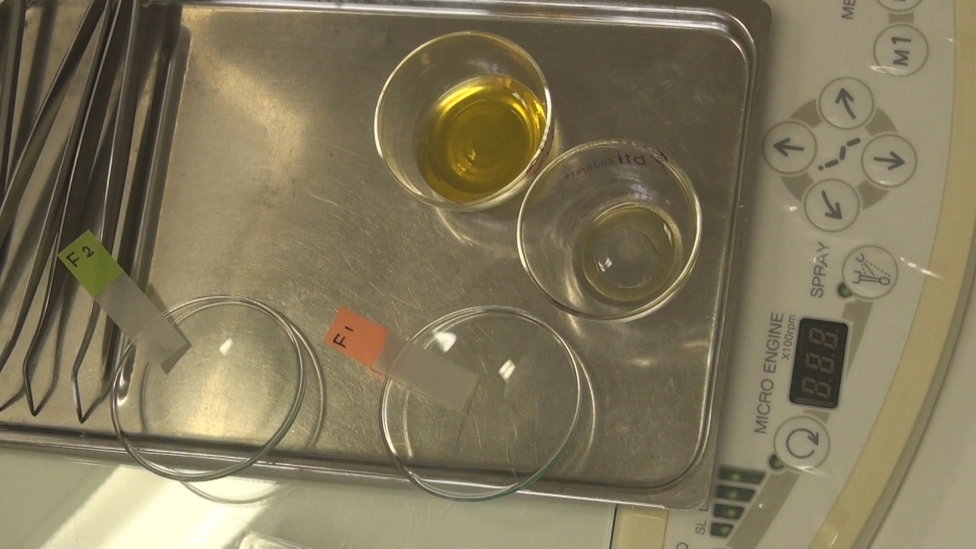 再生歯科治療